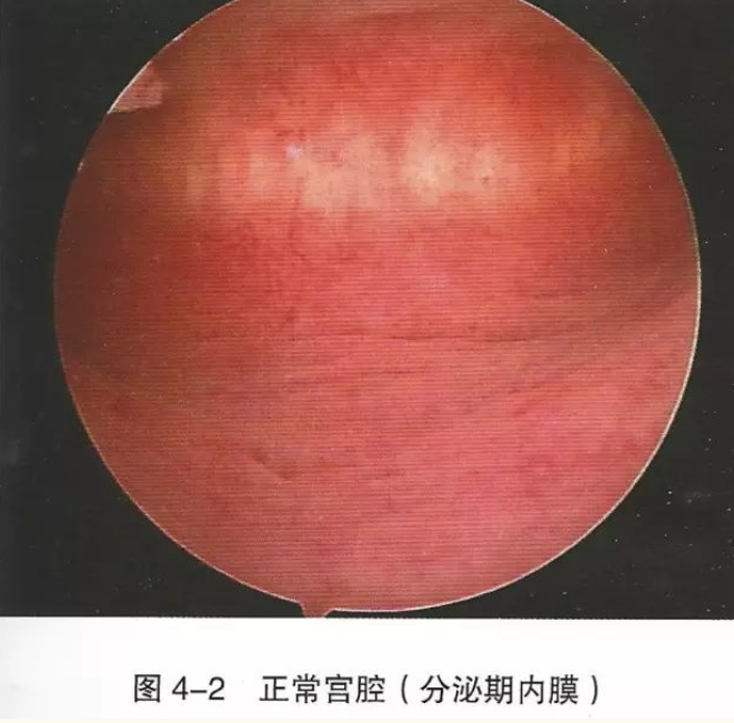 1650443920176218.png image.png