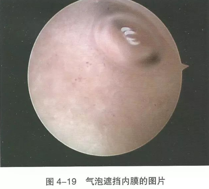 1650444170134248.png image.png