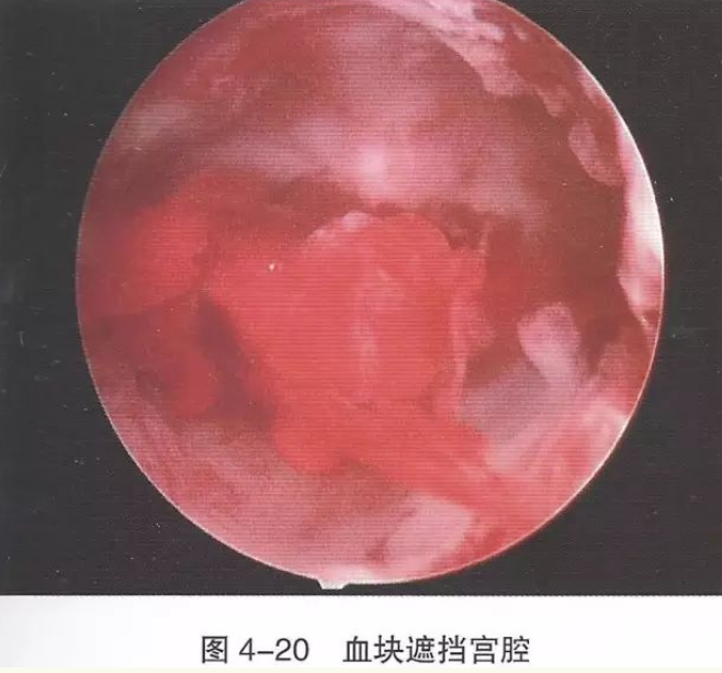 1650444187328783.png image.png