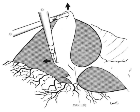 1650446015119470.png image.png