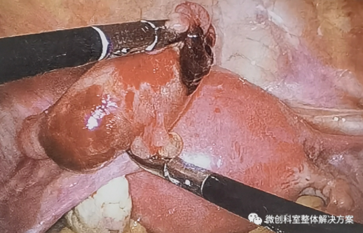 1650522515183208.png image.png