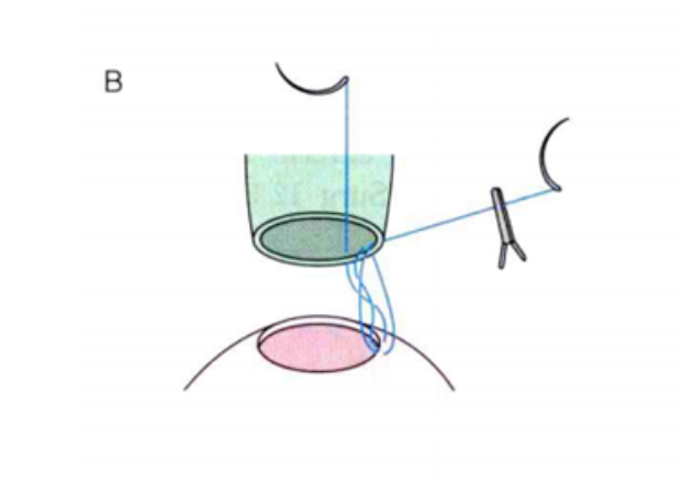 1680500087205987.png image.png