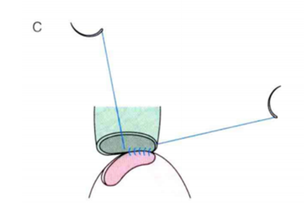 1680500104100092.png image.png