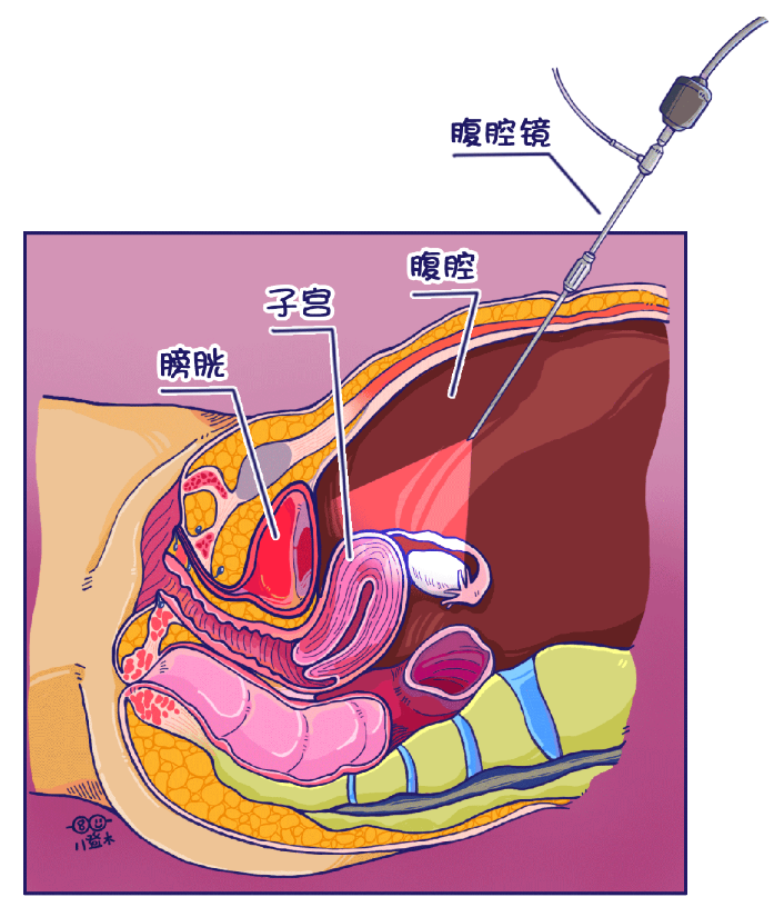 1693811869928710.png image.png