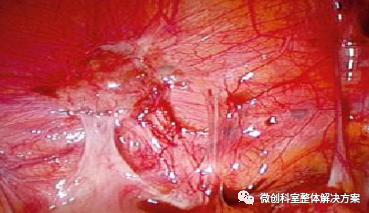 1693812020177704.png image.png