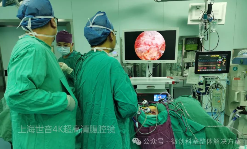 【普外科腹腔镜篇】4K超高清腹腔镜下肾上腺切除术